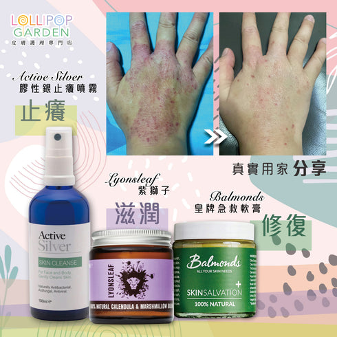 Active Silver 升級版膠性銀止癢噴霧 Skin Cleanse