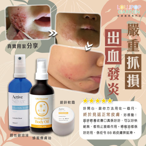 Active Silver 膠性銀鋅軟霜 Hit The Spot Colloidal Silver Cream