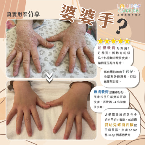 Edenswear 抗敏防護車縫手套 一對 ( 3歲至成人 )