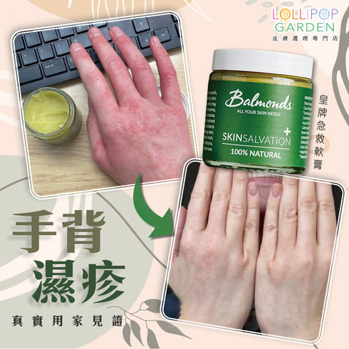 Balmonds 皇牌急救軟膏 ( 新配方 ) Skin Salvation