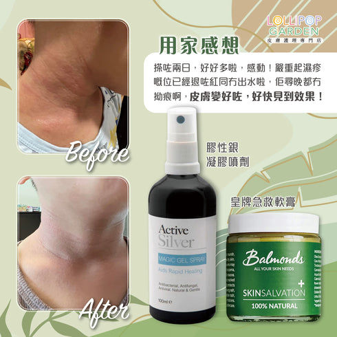 Balmonds 皇牌急救軟膏 ( 新配方 ) Skin Salvation
