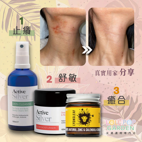 Active Silver 升級版膠性銀止癢噴霧 Skin Cleanse