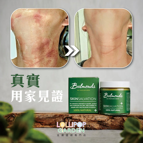 Balmonds 皇牌急救軟膏 ( 新配方 ) Skin Salvation