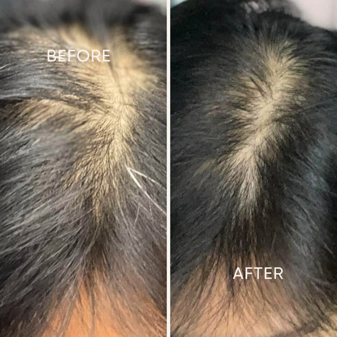 Regrowz 去頭皮育髮洗頭水 Anti-Dandruff Shampoo