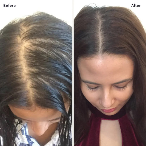 Regrowz 奇蹟生髮護髮油 Miracle Hair Oil