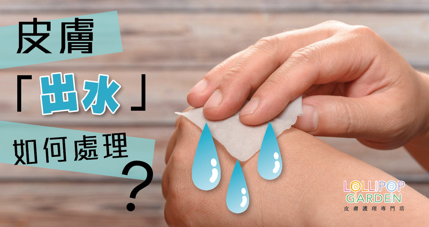 皮膚「出水」如何處理？不靠類固醇和藥物，都可令患處「收水」！ – Lollipop Garden Hong Kong